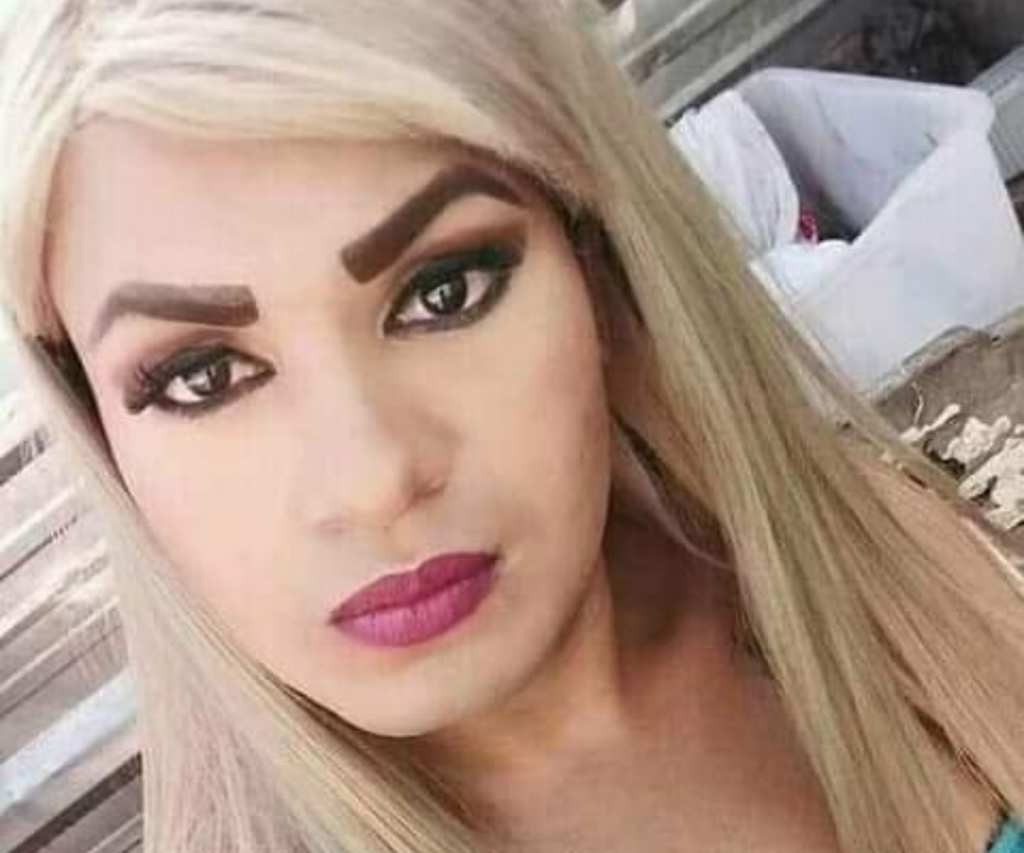 Estilista trans falleció en Babahoyo luego de un procedimiento estético