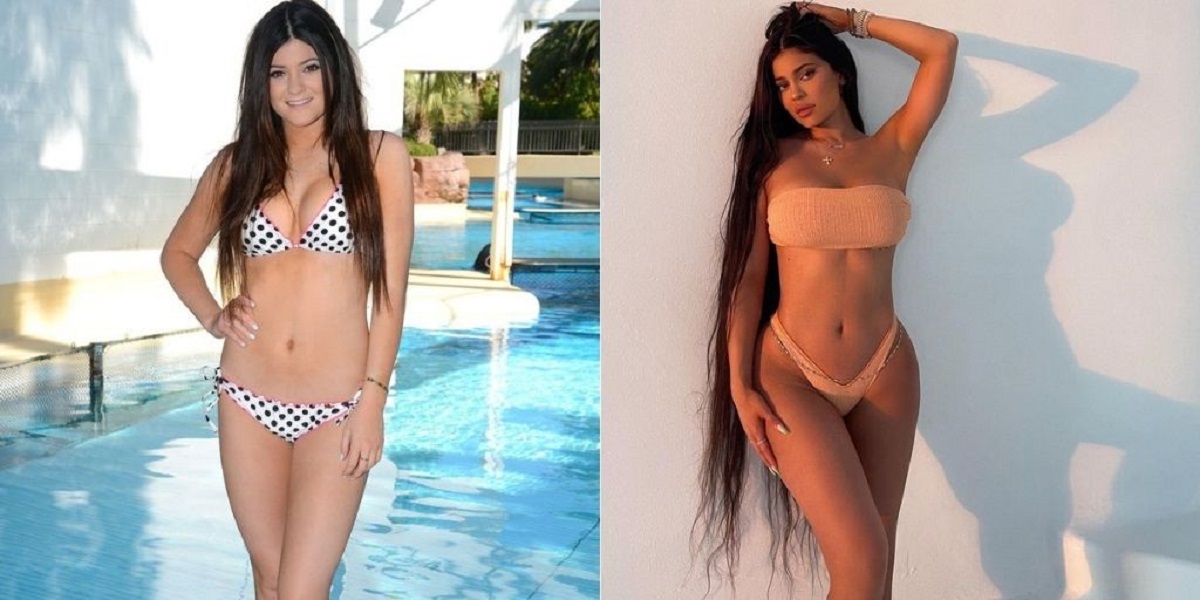 Permanecer Puñalada Estúpido Kylie Jenner antes y después de las cirugías en fotos