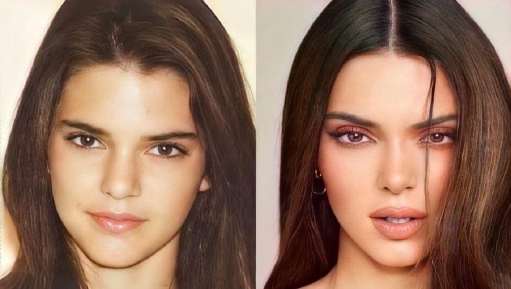 La Evolución De Kendall Jenner Antes Y Después De La Fama Fotos Qué Noticias