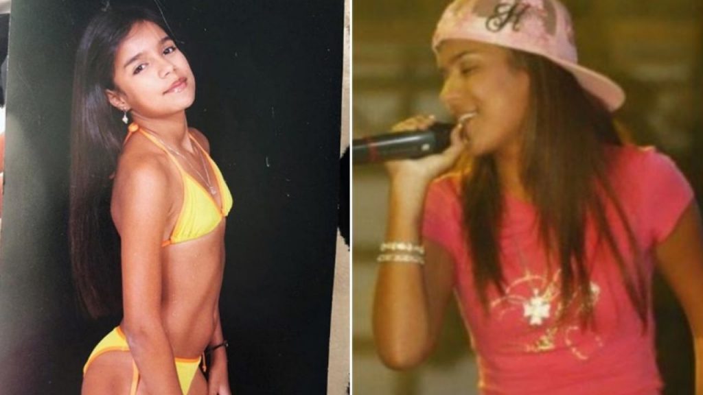 Karol G Antes Y Después De Hacerse Sus Cuatro Cirugías 6046